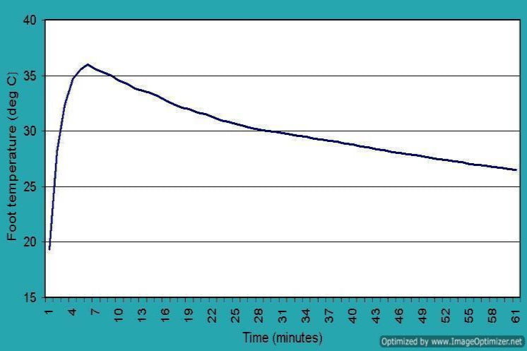 Foot Temperature Graph
